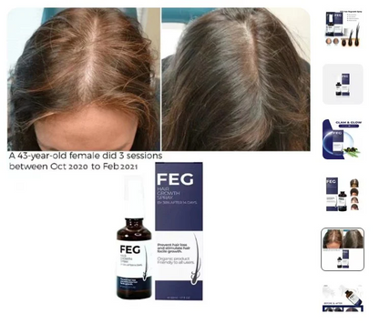 FEG Hair Growth Spray - Natural Hair Restoration for Thicker, Stronger Hair