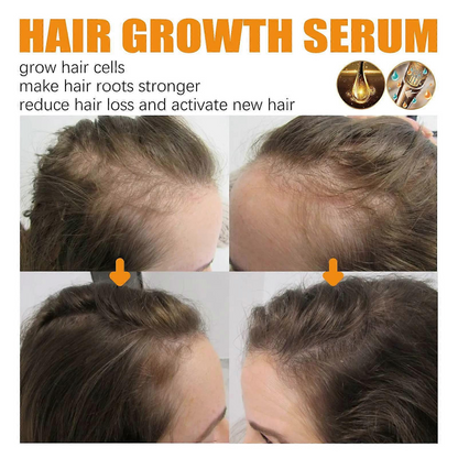 EELHOE Hair Growth Essential Oil - Nourishing Scalp & Thicker Hair Formula