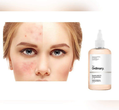 The ordinary- glycolic acid 7% toning solution 240ml - imane Habibi